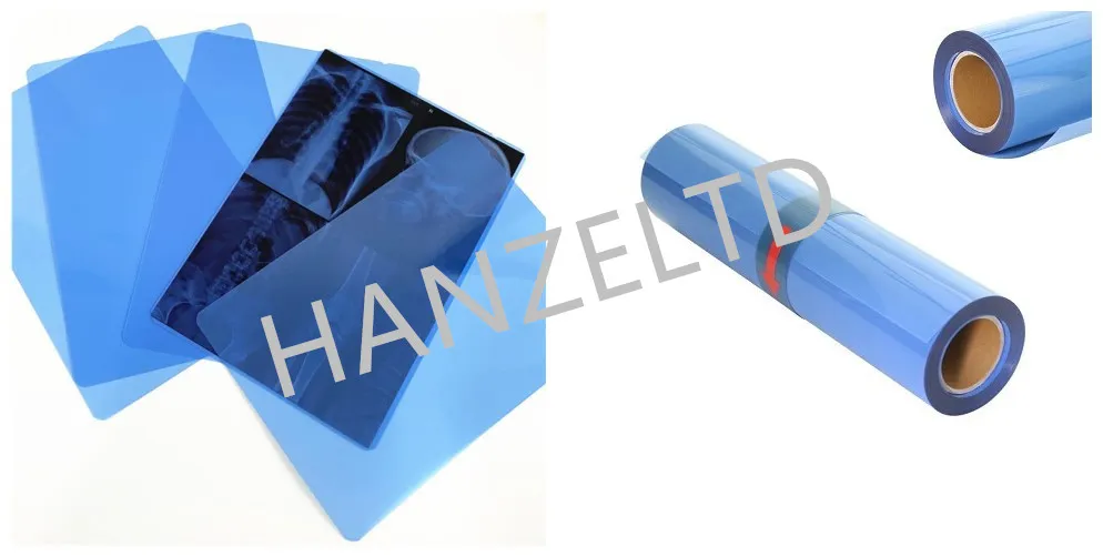 Medical Blue Inkjet X-ray Film
