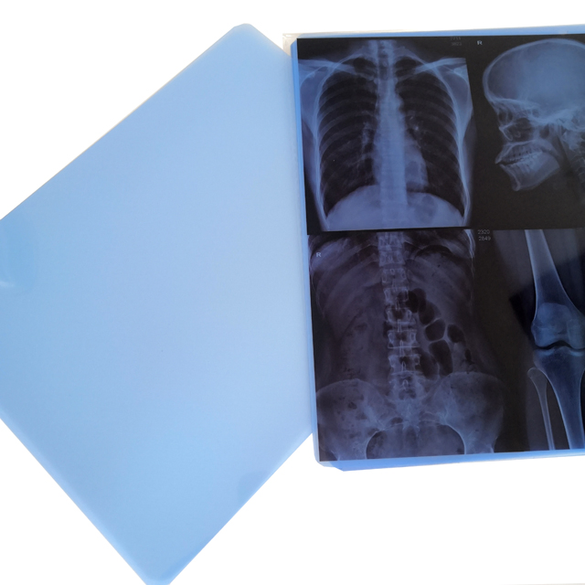 14X17 8X10 Pet Medical Blue Inkjet X-ray Blue Film for Sale with Competitive Price