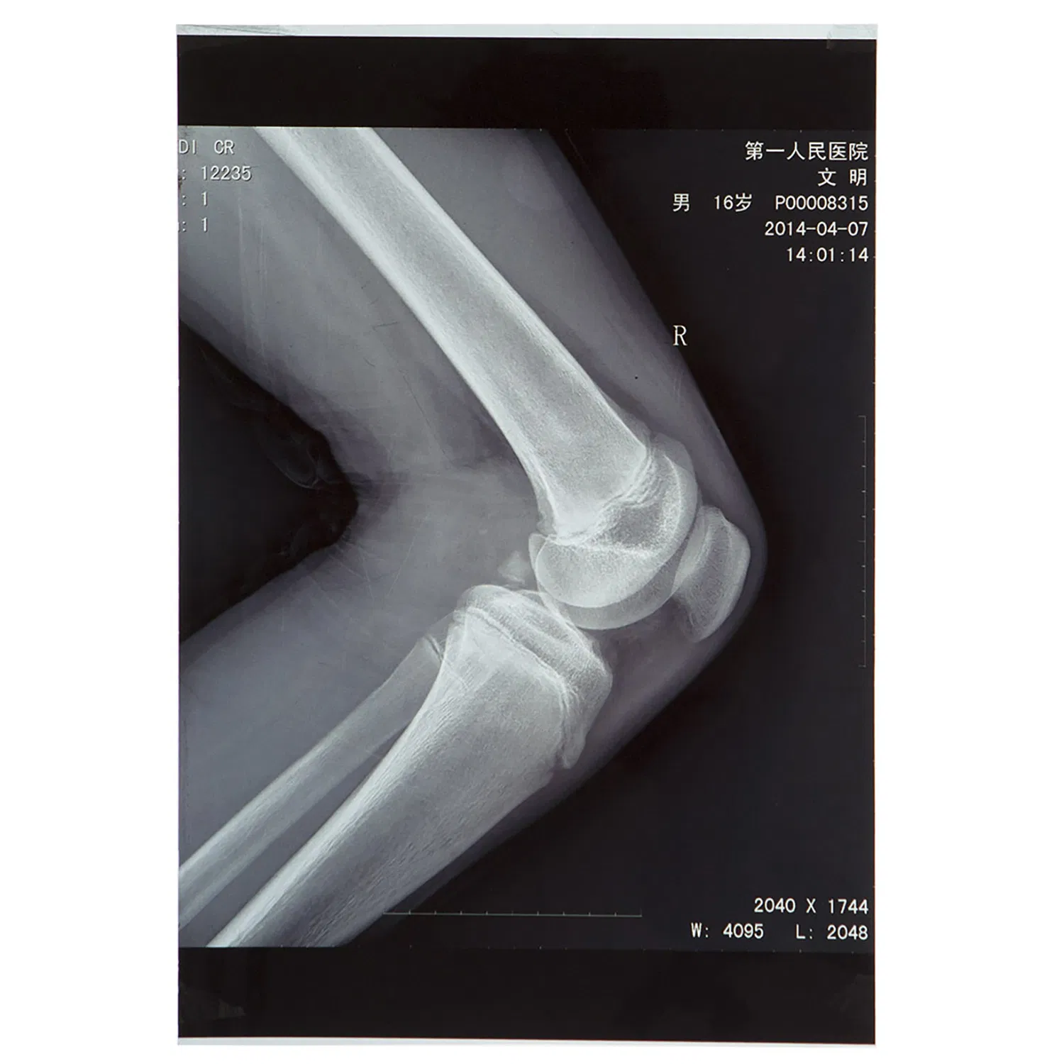 FUJI Printer Using Laser/Thermal Medical X-ray Film 35X43 Cm