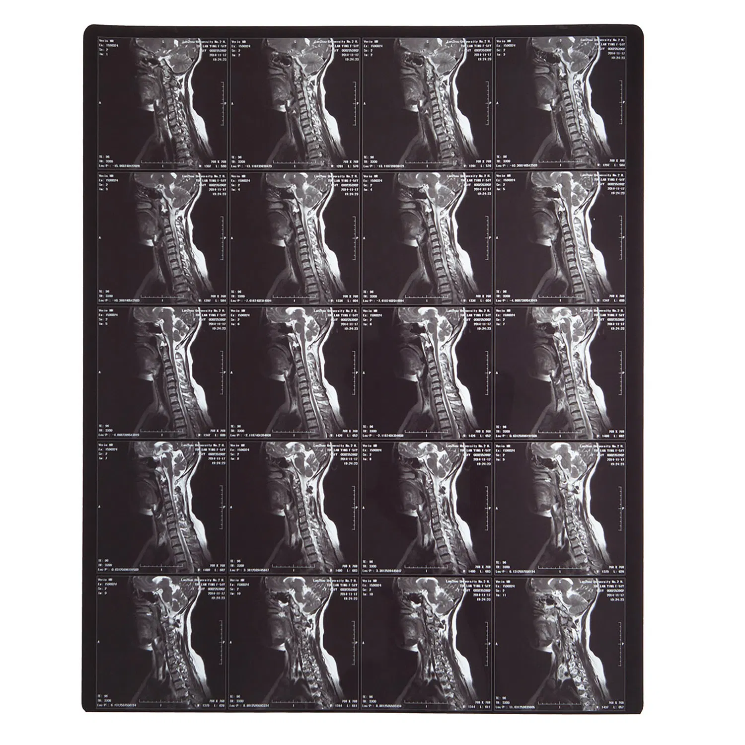 FUJI Printer Using Laser/Thermal Medical X-ray Film 35X43 Cm