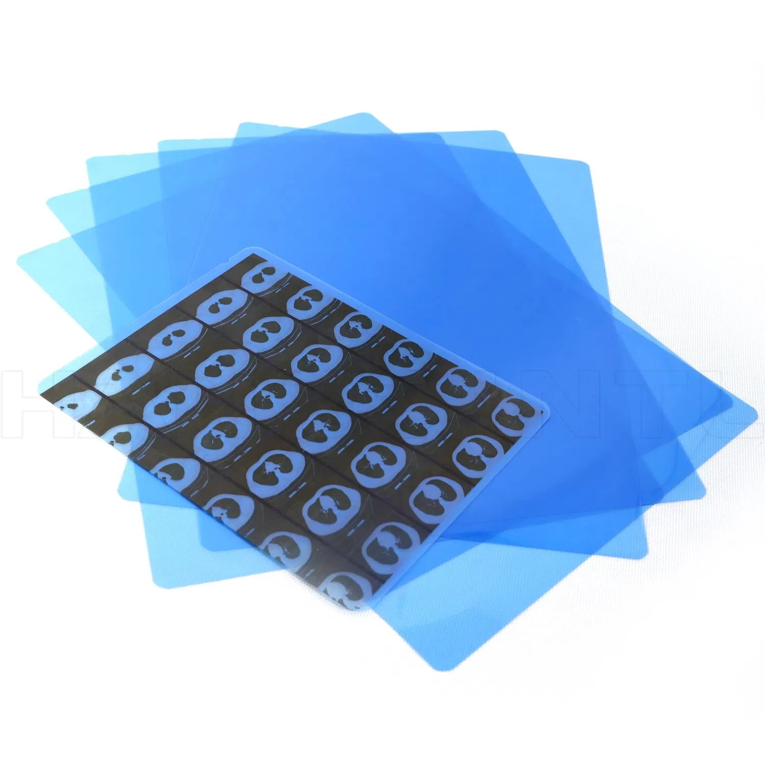 14X17 8X10 Pet Medical Blue Inkjet X-ray Blue Film for Sale with Competitive Price