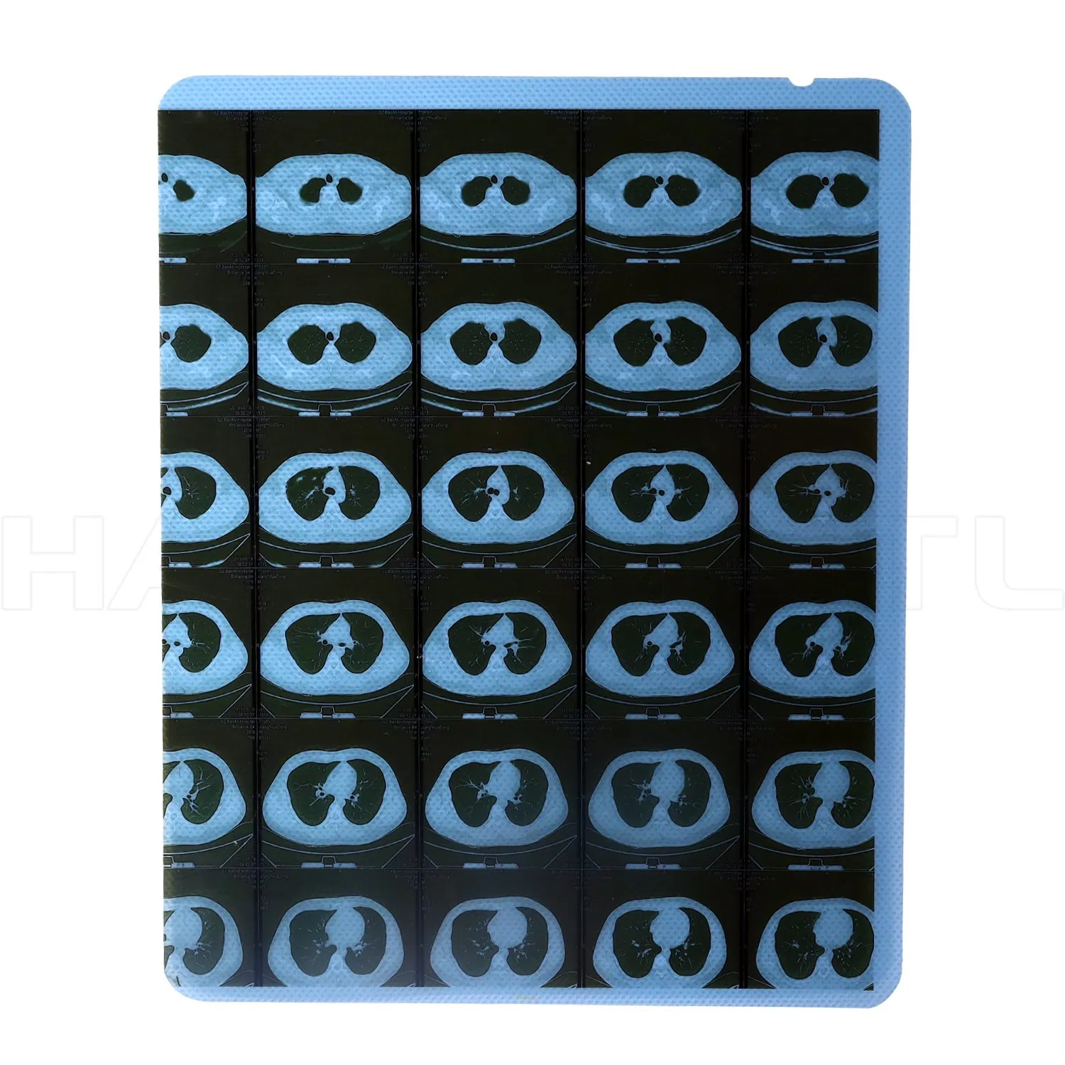 14X17 8X10 Pet Medical Blue Inkjet X-ray Blue Film for Sale with Competitive Price