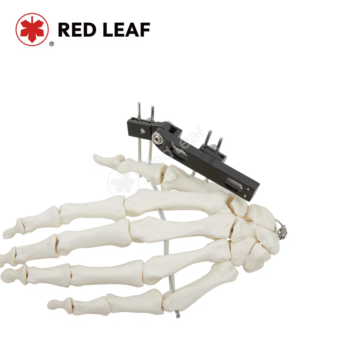 Professional Fracture Finger Track Vertical Axis External Fixator Palm Orthopedic Fixation