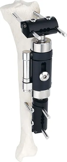 External Fixator--Dynamic Axial Fixator