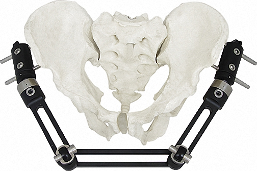 Lightweight External Fixator for Bone Fixation, White &amp; Black Stainless Steel