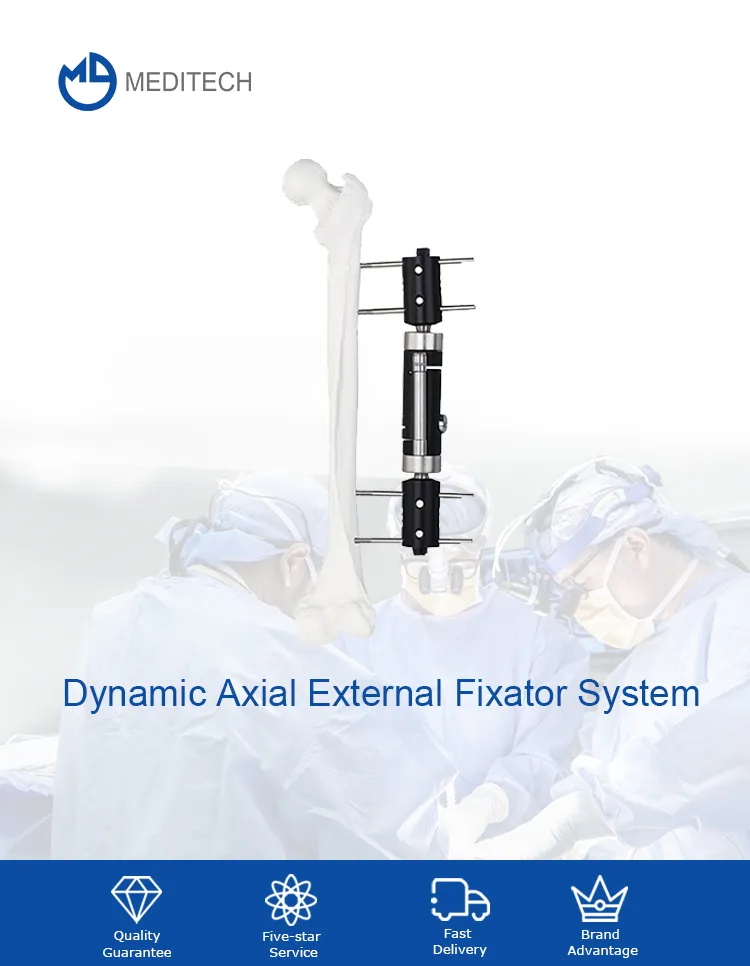 Dynamic Axial External Fixator