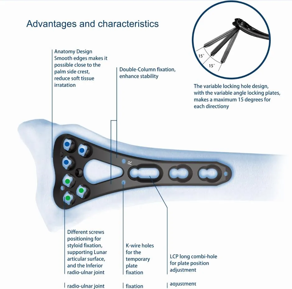 Screw Locking Mechanism