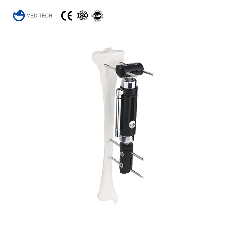 Customizable Dynamic Axial Tibia &amp; Femoral Orthopedic Trauma Bone Lengthening External Fixator