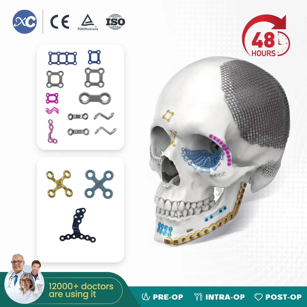 Orthopedic Implants Orthognathic Surgery 1.5mm/2.0mm Maxillofacial Plastic Plate