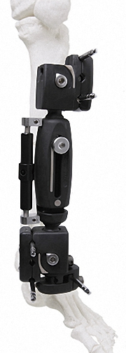 Lightweight External Fixator for Bone Fixation, White &amp; Black Stainless Steel