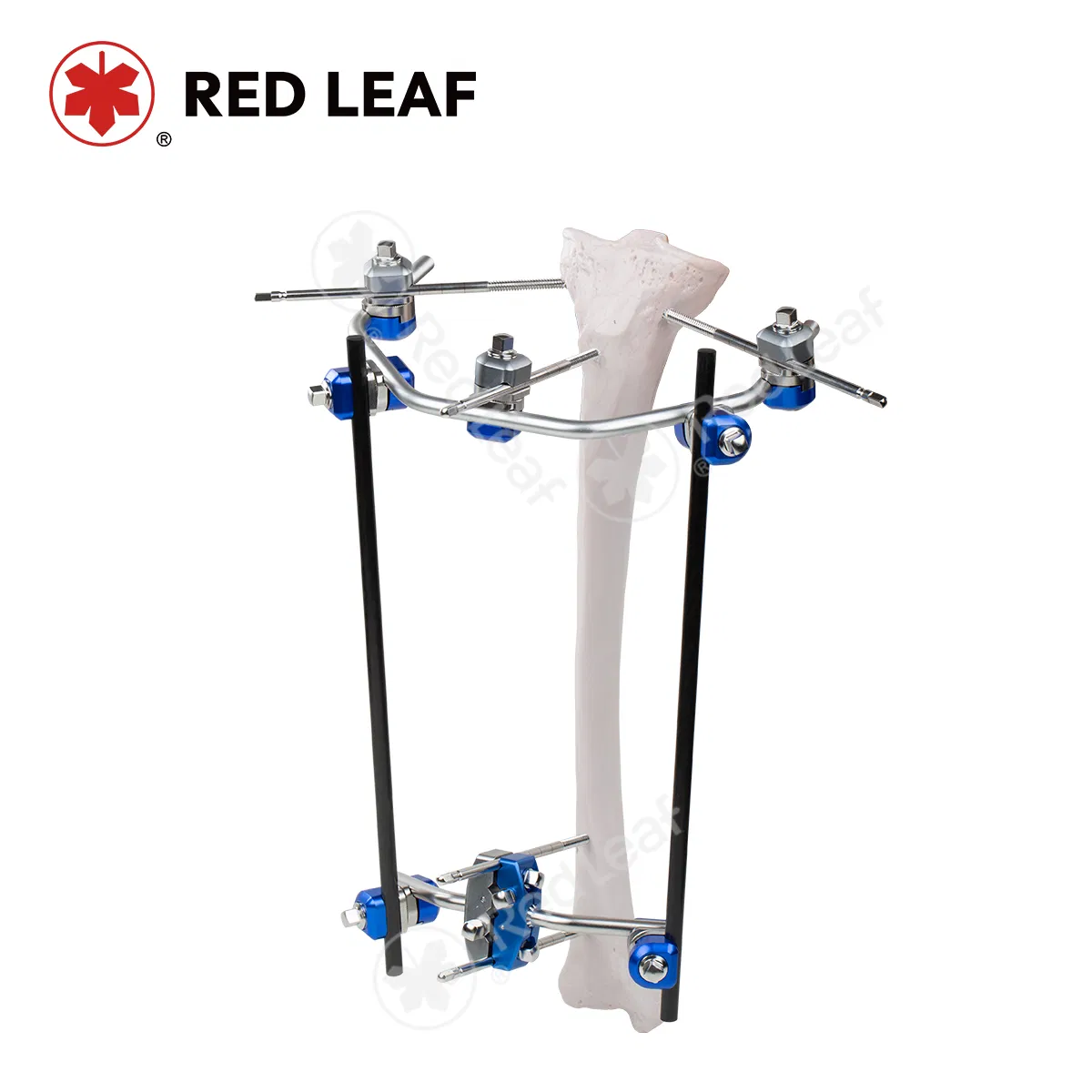 Proximal Tibia External Fixator Medical Orthopedic Instrument Bone Fracture Surgical Fixation