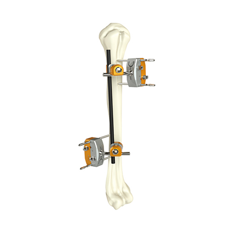 Hoffman Combinationhumeral Shaft External Fixator for Orthopedic Fixation