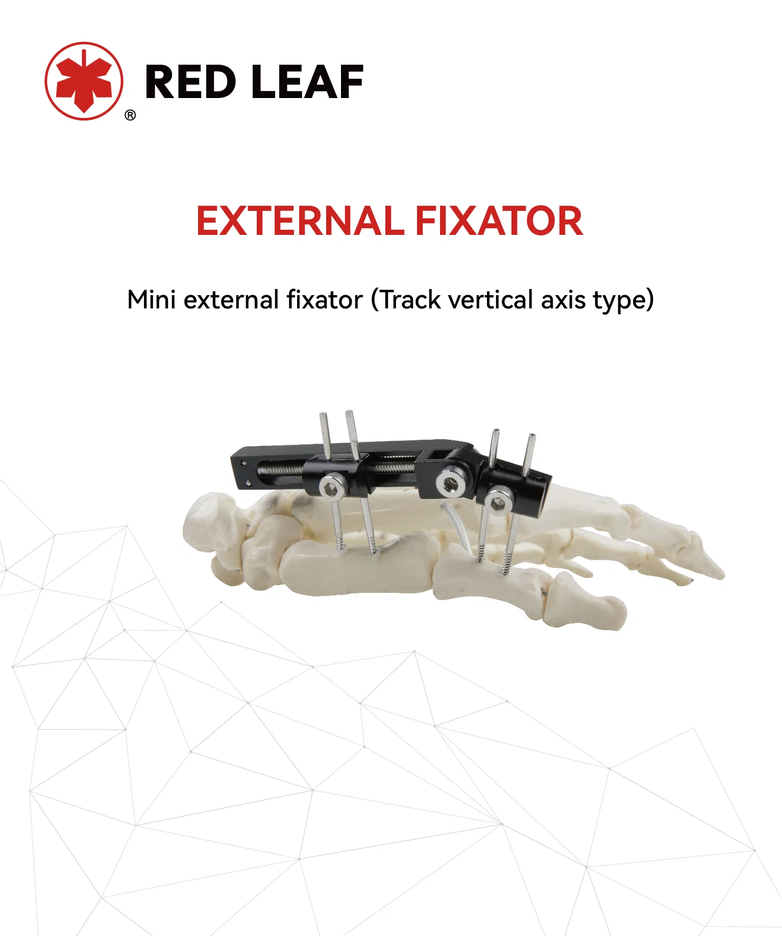 Fracture Finger Track Vertical Axis External Fixator