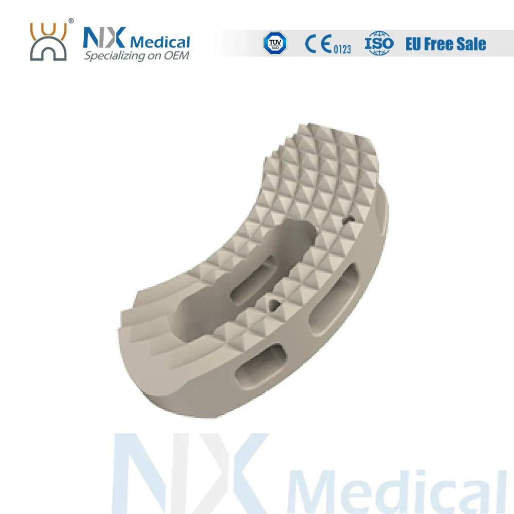 Nx Medical Titanium Tlif Cage Peek for Lumbar Interbody Fusion Large Window