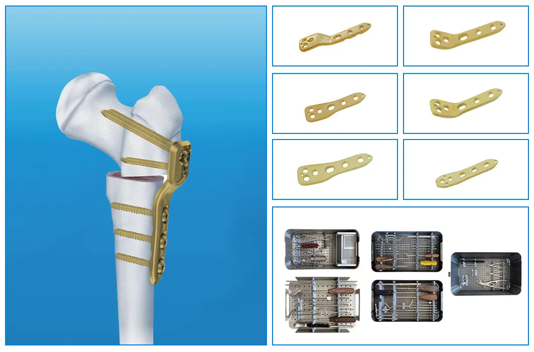 Product Technical View