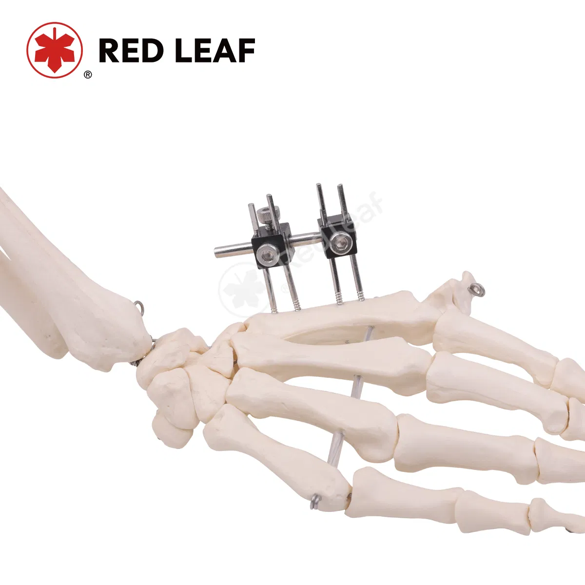 Mini Finger Universal External Fixation Medical Instrument Orthopedic Fracture Fixator