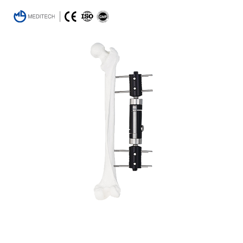 Customizable Dynamic Axial Tibia &amp; Femoral Orthopedic Trauma Bone Lengthening External Fixator
