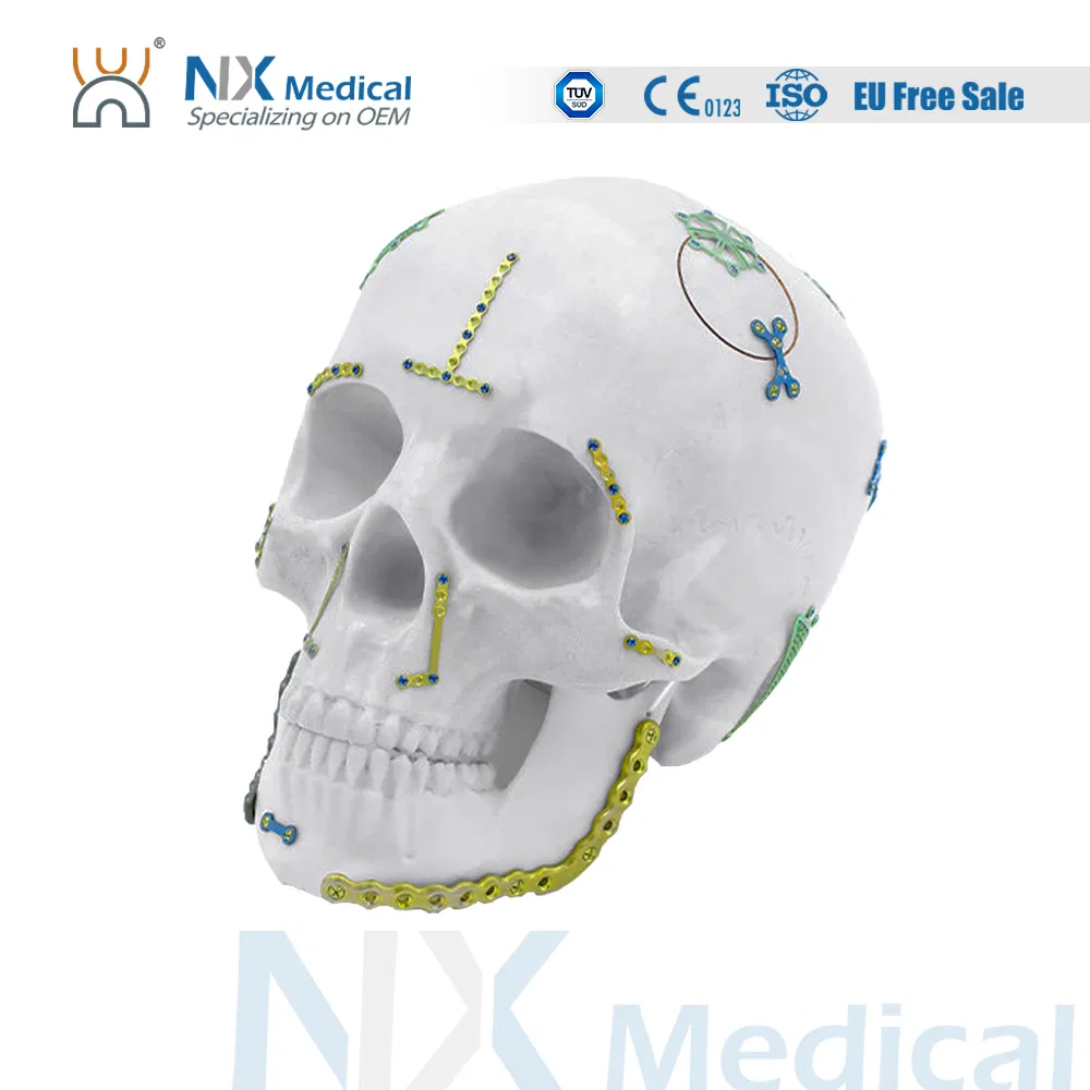 Nx Medical Titanium Medical Orthopedic Trauma Maxillofacial Bone Fracture Reconstruction LCP Locking Compression Plate