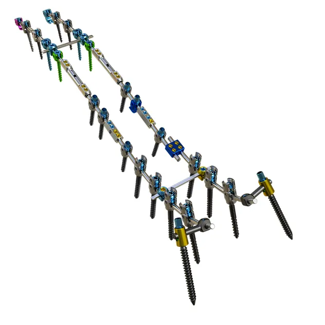Thoracolumbar Pedicle Screw and Rod System 1