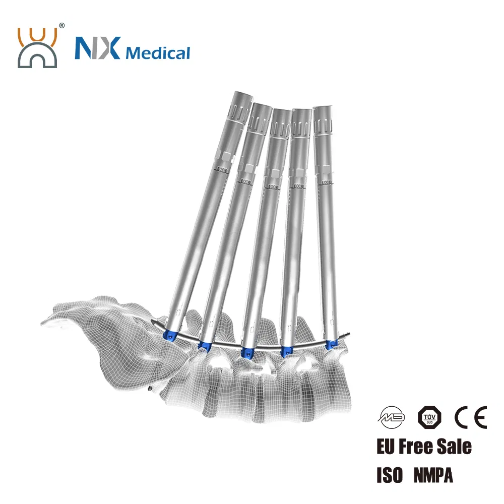 Nx Medical Titanium Cannulated Bone Cement Pedicle Screw 5.5mm Spine Internal Fixation