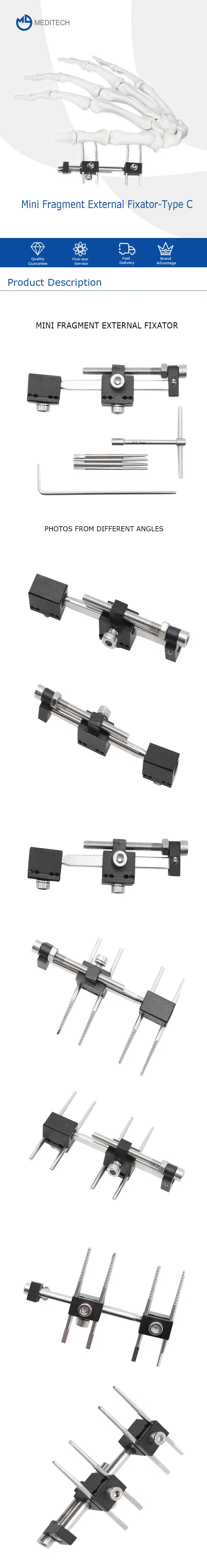 Mini Fragment External Fixator