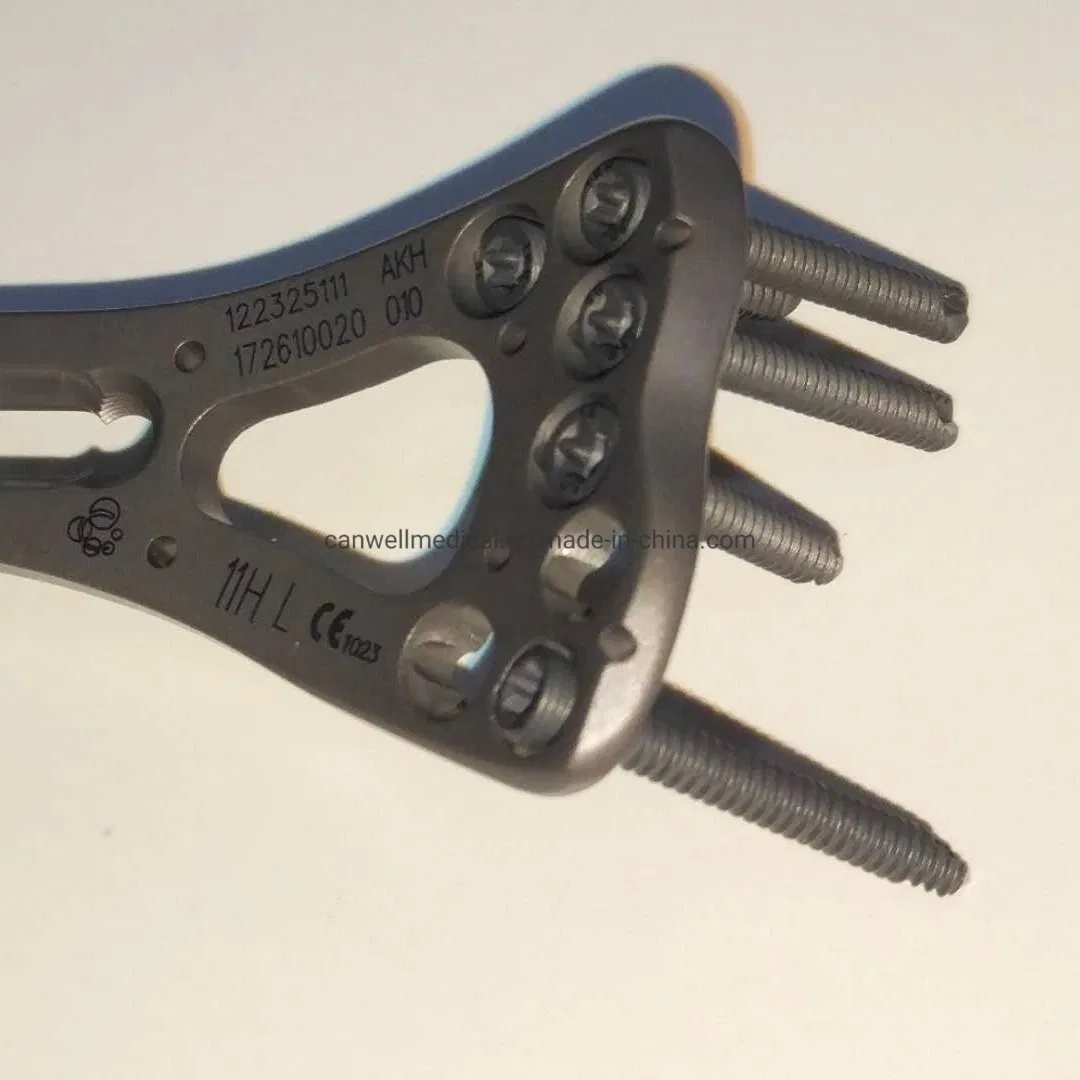 Canwell Distal Radius Ulna Fracture Surgical Implant and Medical Orthopaedic Trauma Small Fragment Fixation Surgery Orthopedic Titanium Bone Locking Screw Plate