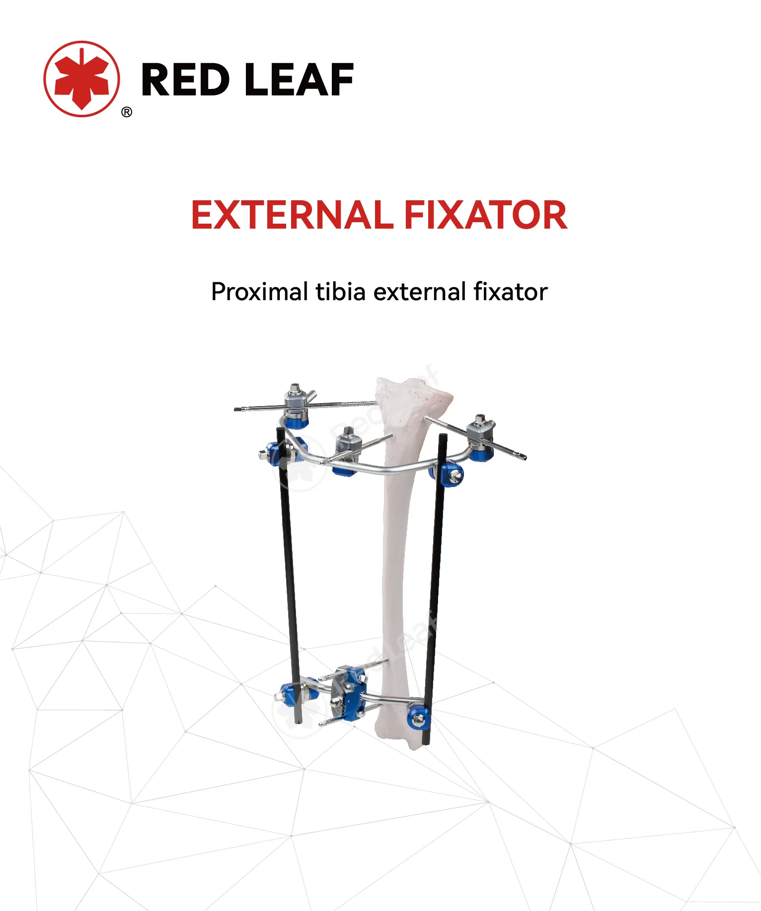 Proximal Tibia External Fixator