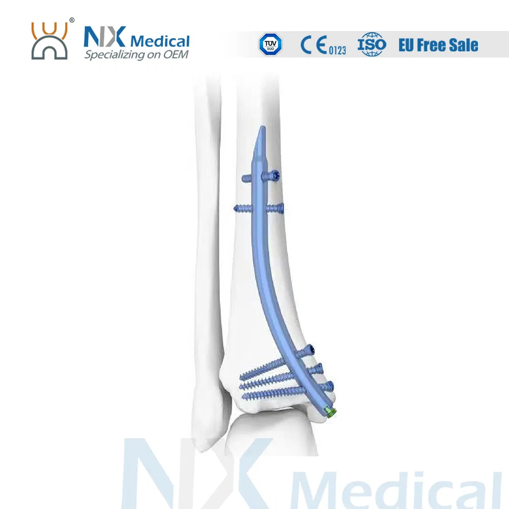 China Factory Nx Medical Orthopedic Trauma Implant Titanium Retrograde Tibial Intramedullary Nail