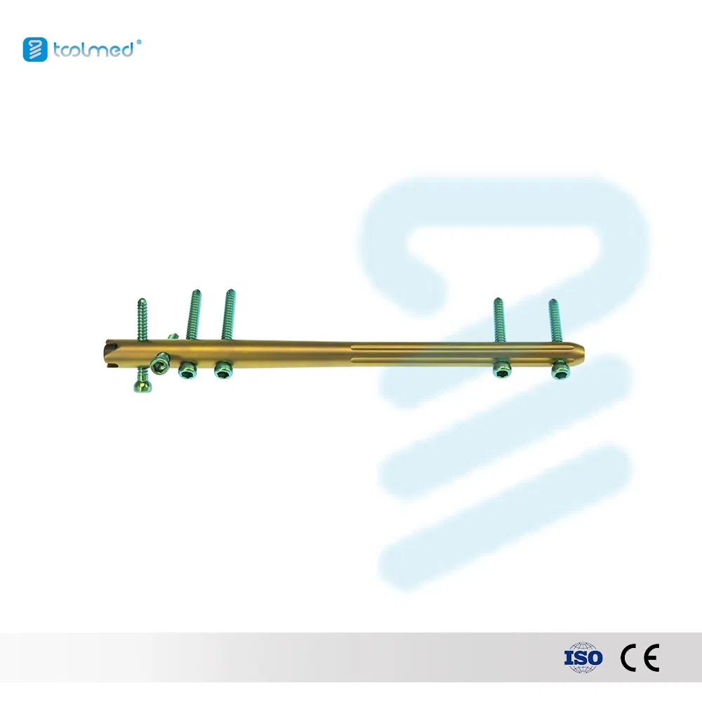 Orthopedic Trauma Interlocking Intramedullary Nail for Femur 9.5*340