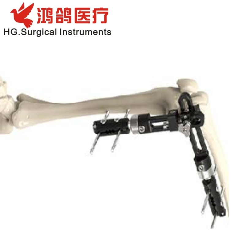 Orthopedic Instrument Elbow Joint External Fixator Knee Joint External Fixator