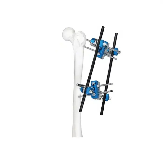 Geasure Combined External Fixator Combined Orthopedic External Fixation