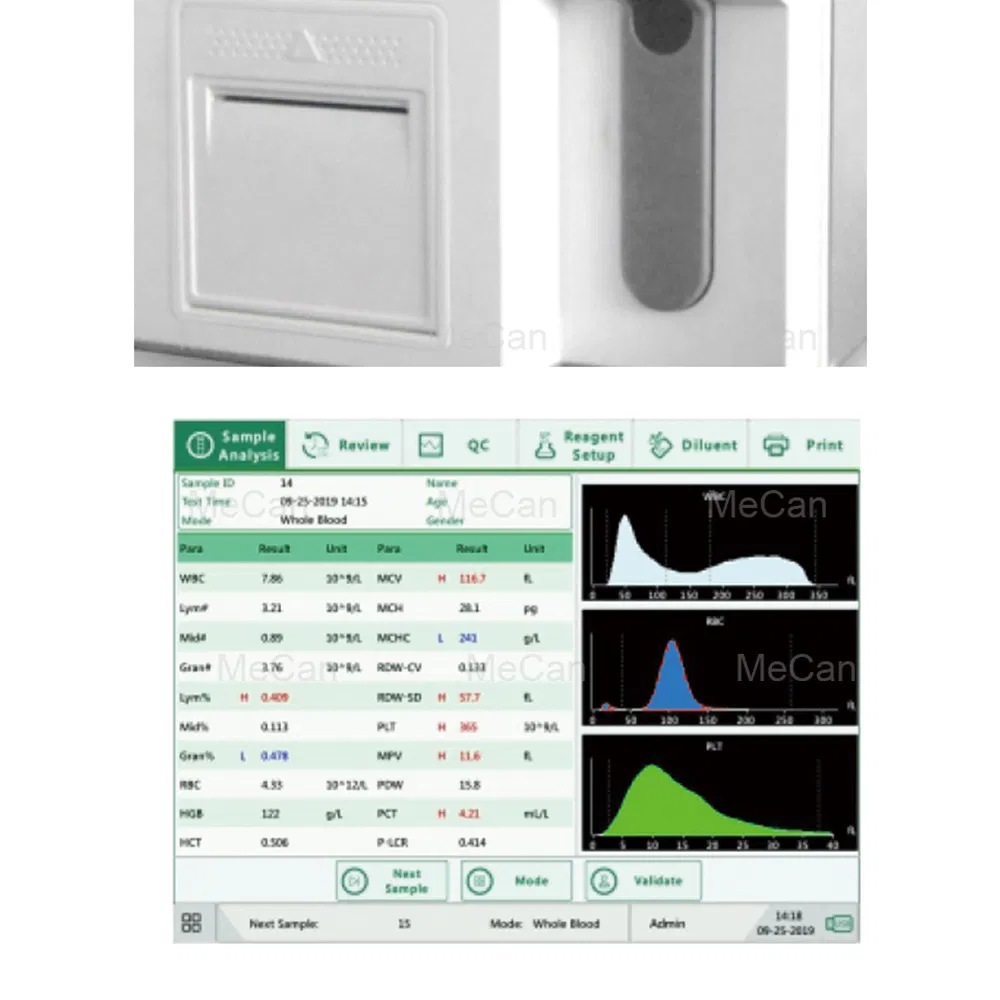 Cbc Machine Auto Auto Hematology Analyzer 3 Part