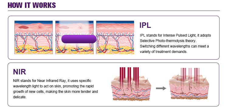 IPL Laser Beauty Machine Side View