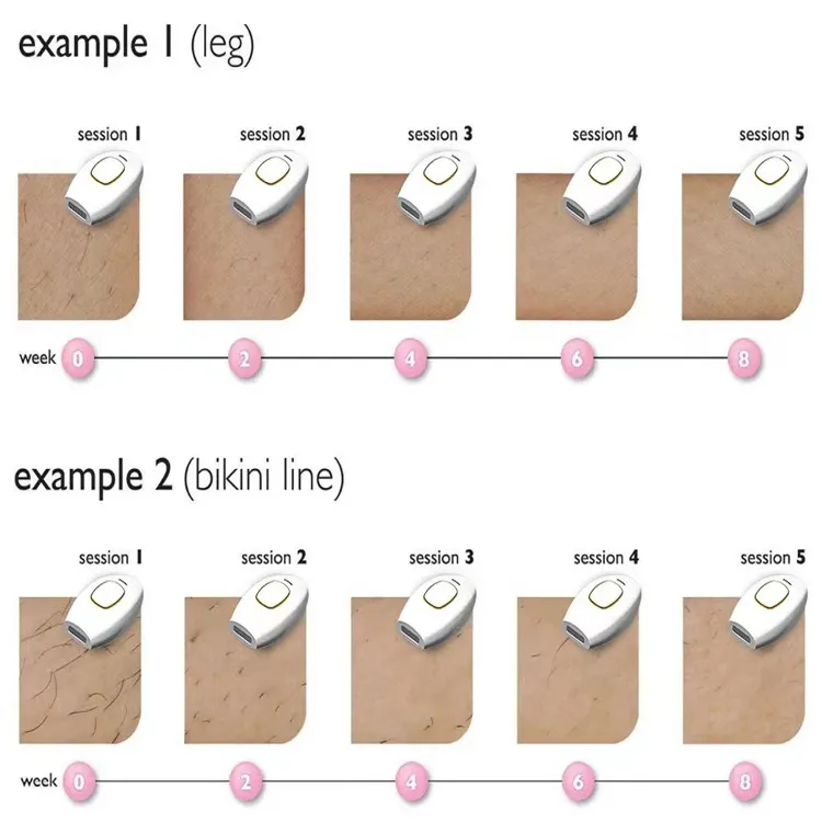 Portable Women IPL Laser Body Hair Removal Device