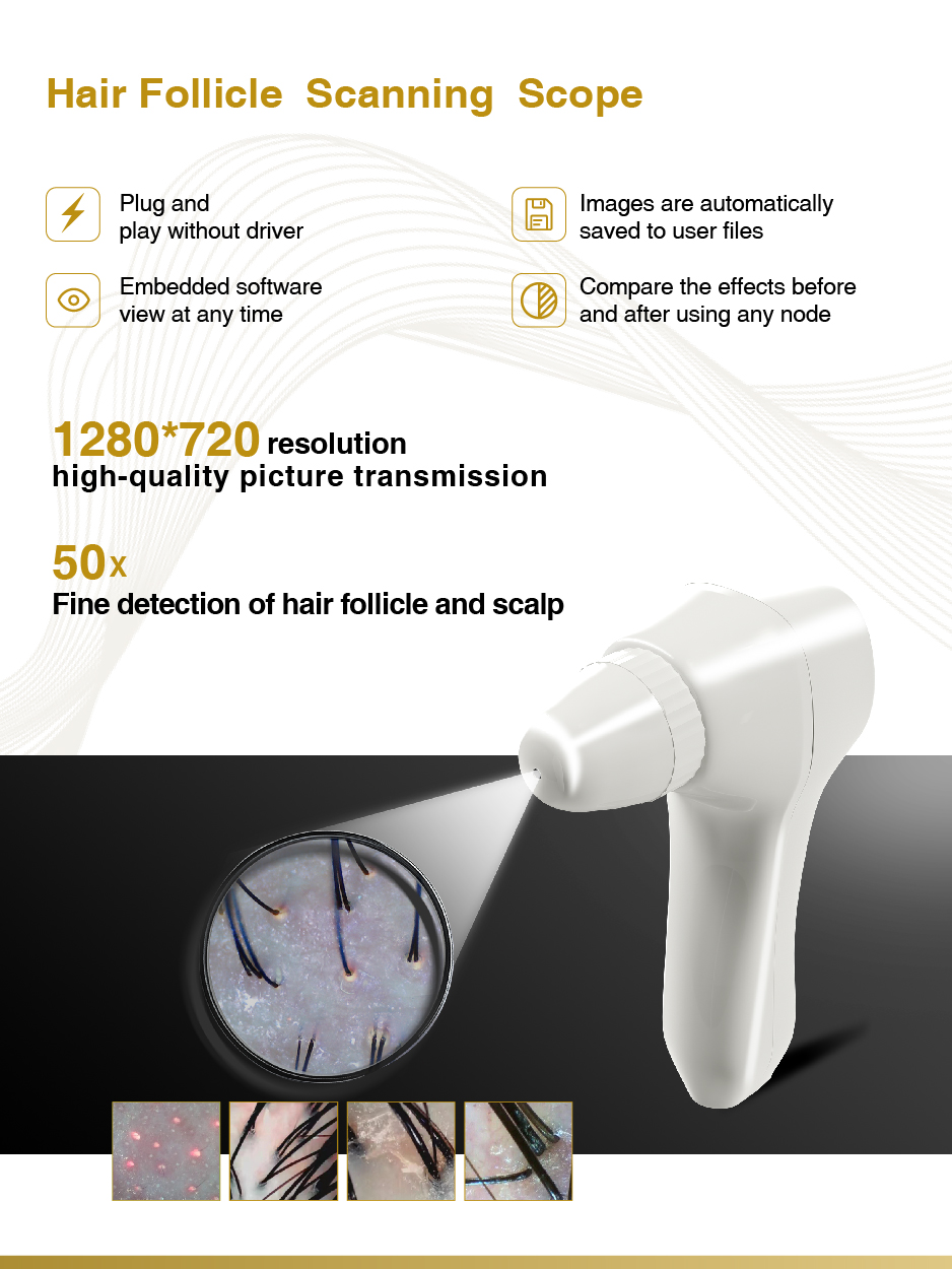 Intelligent Handle Screen