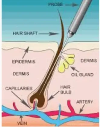 Vascular Removal Before and After Comparison 1