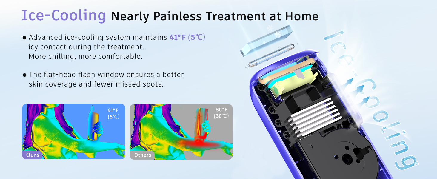 IPL device detail 7