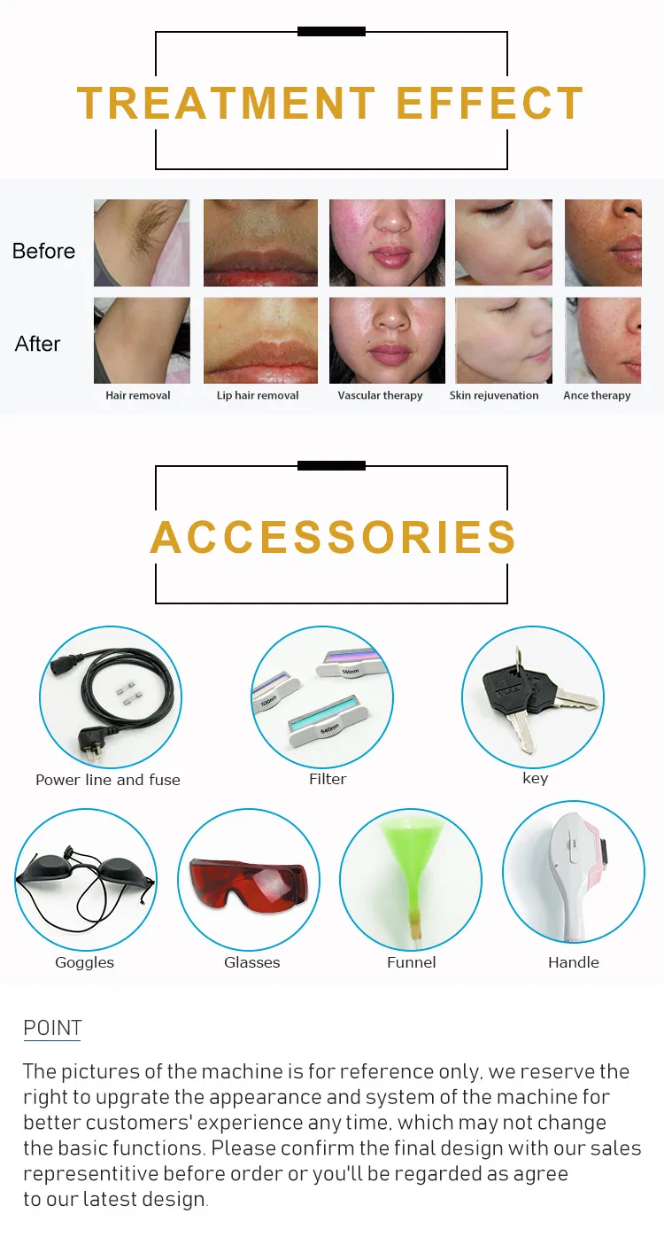 IPL Hair Removal Treatment Parameters