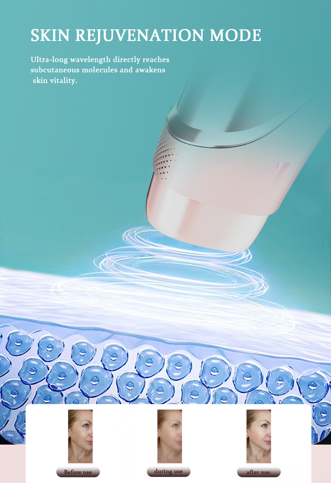 IPL Device Function