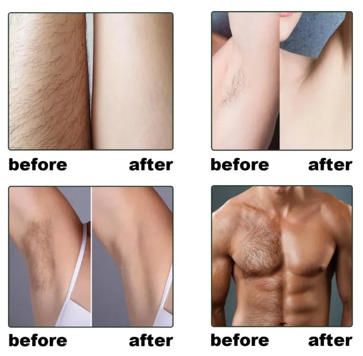 Hair Growth Cycle Chart