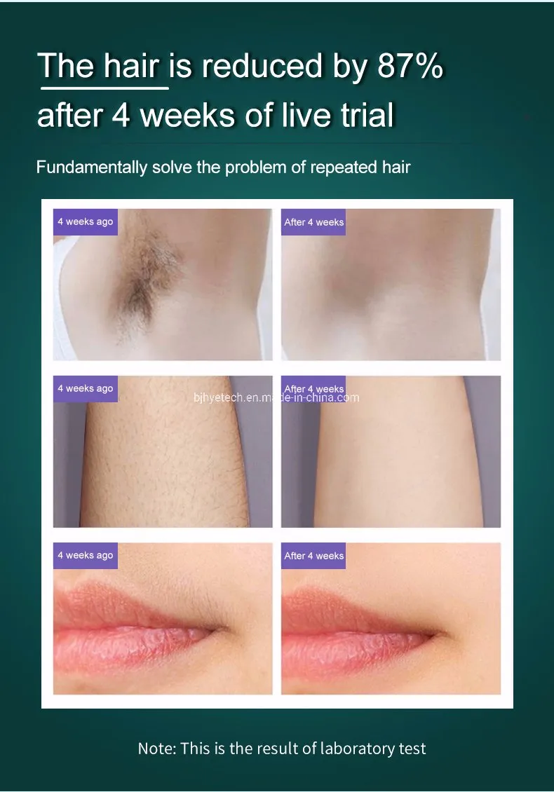 Home Use Portable Hair Removal Application