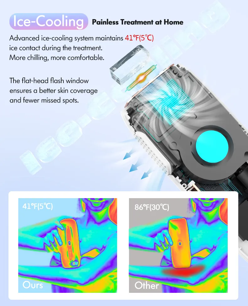 IPL Hair Removal Device Portable Laser Hair Removal for Home & Salon