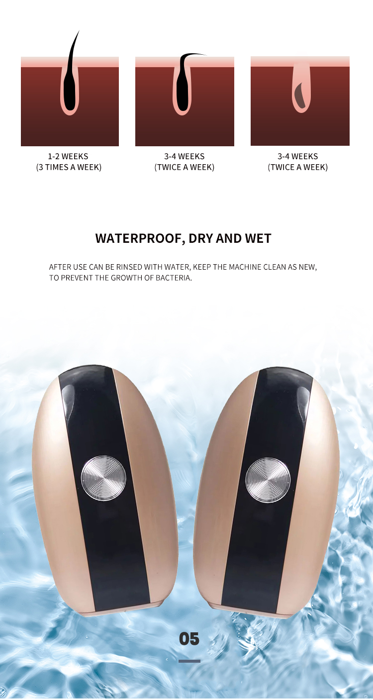 Freezing point hair removal detail 5