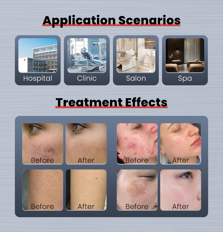 Treatment Result 2