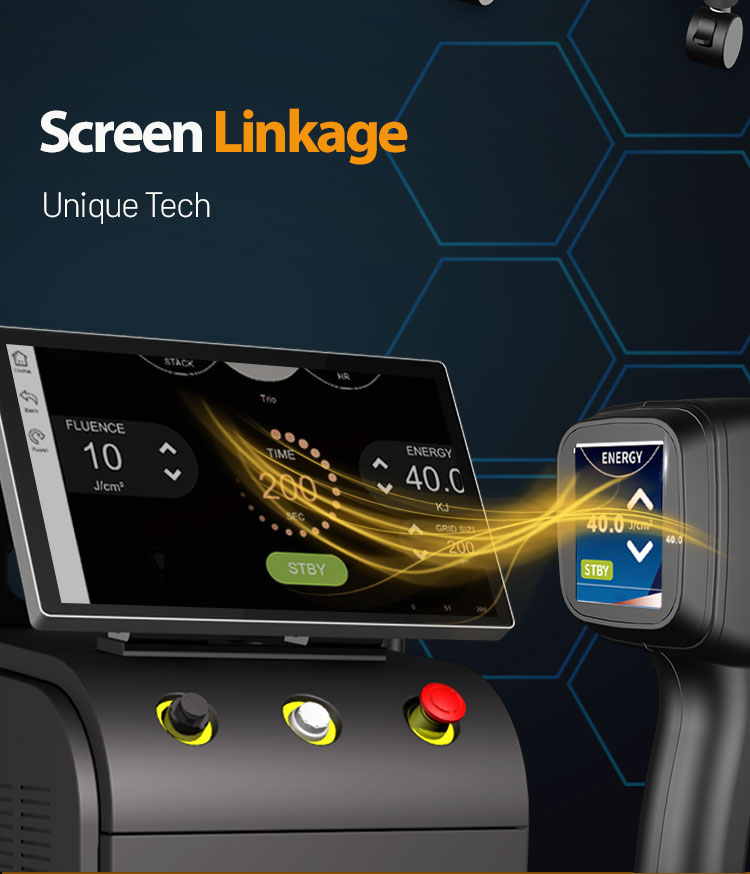 Intelligent Handle Screen Touch display