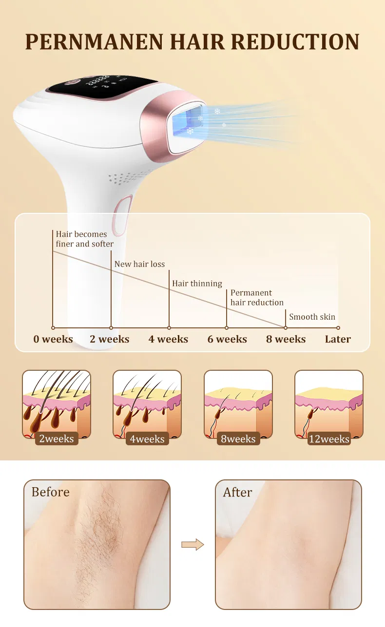 Portable IPL Hair Removal Device with Pain-Free Permanent Hair Reduction