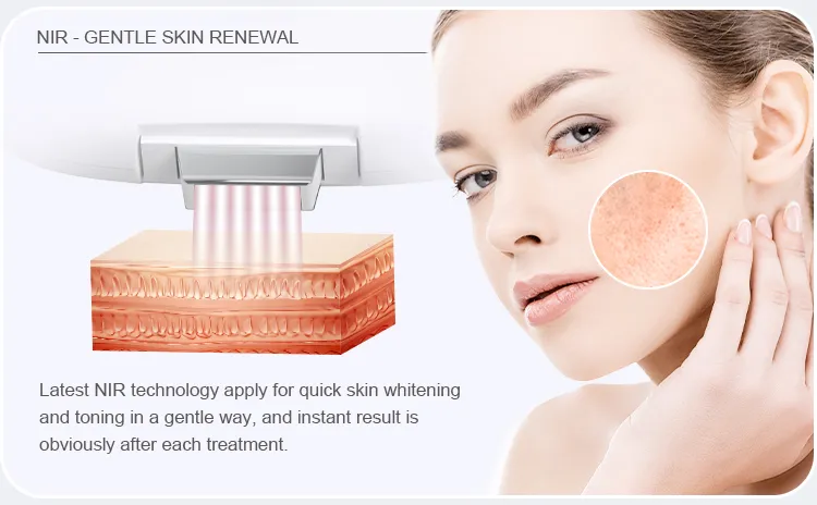Portable IPL / Dpl Laser Hair Removal Device Detail 3