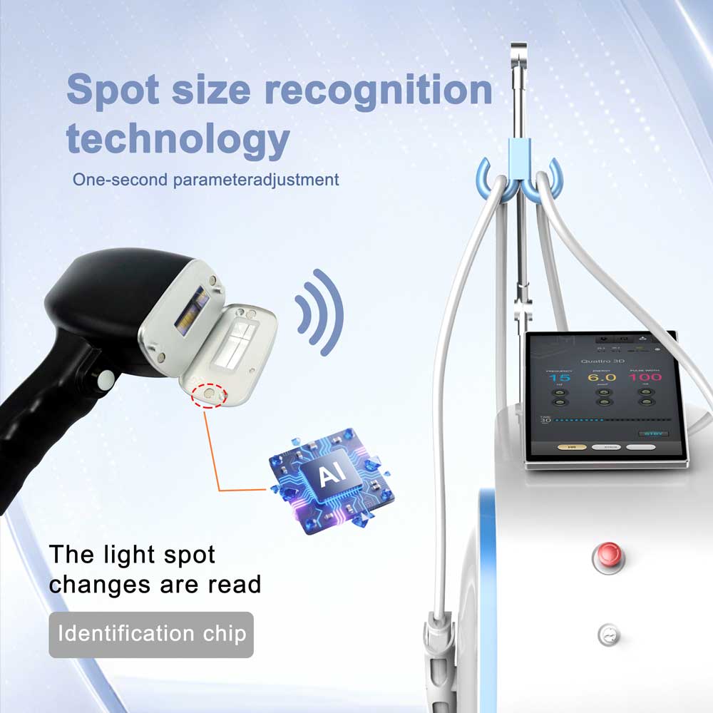 Weifang KM 17 Years Factory Depilation 1600w 810nm 4 Wave Trio Ice Titanium 755 1064nm 808nm Diode Laser Hair Removal Machine
