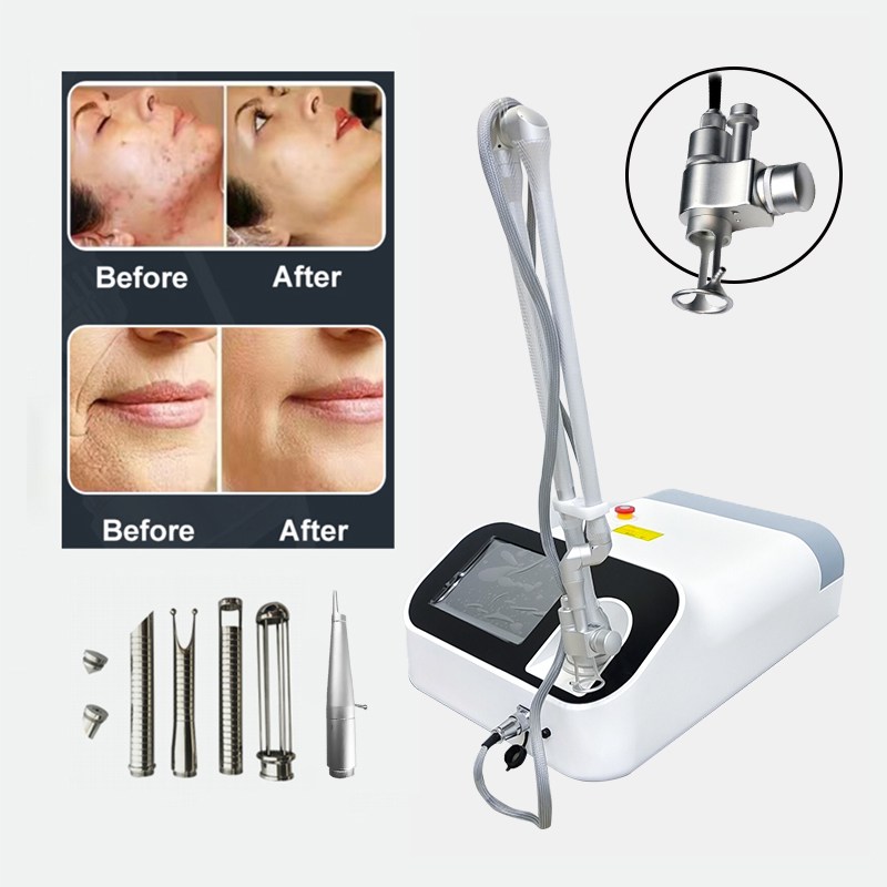High Quality OEM CO2 Fractional Laser Machine Vaginal Tightening Acne Scar Removal Skin Resurfacing Whitening Treatment Device