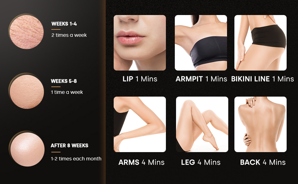 IPL Hair Removal Device View 2